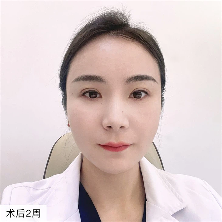 3Double Eyelid Repair Costs